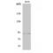 RNA Binding Motif Protein 5 antibody, LS-C384385, Lifespan Biosciences, Western Blot image 