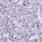 Cyclin-dependent kinase 13 antibody, HPA059241, Atlas Antibodies, Immunohistochemistry paraffin image 