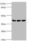ADP Ribosylation Factor GTPase Activating Protein 1 antibody, orb353587, Biorbyt, Western Blot image 
