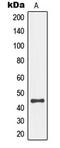 Mitogen-Activated Protein Kinase Kinase 4 antibody, GTX55115, GeneTex, Western Blot image 