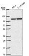 Nucleotide Binding Oligomerization Domain Containing 2 antibody, NBP2-58617, Novus Biologicals, Western Blot image 