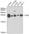 CD99 Molecule (Xg Blood Group) antibody, 18-453, ProSci, Western Blot image 