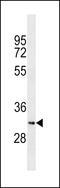 Synaptonemal Complex Central Element Protein 1 Like antibody, 60-311, ProSci, Western Blot image 