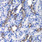 Megakaryocyte-Associated Tyrosine Kinase antibody, LS-C334850, Lifespan Biosciences, Immunohistochemistry paraffin image 