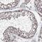 Protein Phosphatase 2 Regulatory Subunit B'Delta antibody, NBP1-88959, Novus Biologicals, Immunohistochemistry frozen image 