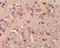 Bromodomain PHD Finger Transcription Factor antibody, orb155862, Biorbyt, Immunohistochemistry paraffin image 