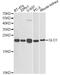 Glyoxalase I antibody, STJ23800, St John