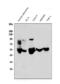 Matrix Metallopeptidase 1 antibody, PB9725, Boster Biological Technology, Western Blot image 
