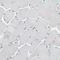 Unc-5 Family C-Terminal Like antibody, HPA015725, Atlas Antibodies, Immunohistochemistry frozen image 