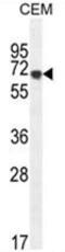 Amylase Alpha 2B (Pancreatic) antibody, AP50167PU-N, Origene, Western Blot image 