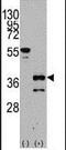 Zic Family Member 4 antibody, PA5-12298, Invitrogen Antibodies, Western Blot image 