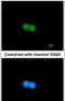 MRE11 Homolog, Double Strand Break Repair Nuclease antibody, PA5-31262, Invitrogen Antibodies, Immunofluorescence image 