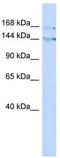 Bromodomain Adjacent To Zinc Finger Domain 1B antibody, TA345371, Origene, Western Blot image 