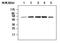 Checkpoint Kinase 1 antibody, MA5-17237, Invitrogen Antibodies, Western Blot image 
