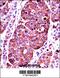 Tyrosinase antibody, 62-844, ProSci, Immunohistochemistry paraffin image 