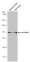 Glutamate Metabotropic Receptor 8 antibody, GTX108159, GeneTex, Western Blot image 