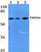 TATA-Box Binding Protein Associated Factor 6 Like antibody, PA5-36226, Invitrogen Antibodies, Western Blot image 