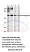 Zeta Chain Of T Cell Receptor Associated Protein Kinase 70 antibody, A00754Y292, Boster Biological Technology, Western Blot image 