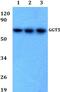 Gamma-Glutamyltransferase 5 antibody, PA5-75778, Invitrogen Antibodies, Western Blot image 