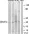 Olfactory Receptor Family 4 Subfamily F Member 6 antibody, LS-C199352, Lifespan Biosciences, Western Blot image 