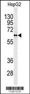 Phospholipid Transfer Protein antibody, 63-053, ProSci, Western Blot image 