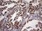 ATP Synthase Peripheral Stalk Subunit OSCP antibody, NBP2-46555, Novus Biologicals, Immunohistochemistry paraffin image 