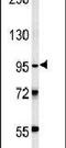 Thyrotropin Releasing Hormone Degrading Enzyme antibody, PA5-25545, Invitrogen Antibodies, Western Blot image 