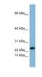 Small Proline Rich Protein 3 antibody, NBP1-57679, Novus Biologicals, Western Blot image 