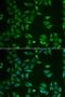 ST3 Beta-Galactoside Alpha-2,3-Sialyltransferase 4 antibody, orb247358, Biorbyt, Immunofluorescence image 