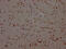 Bromodomain Containing 4 antibody, CSB-RA152430A0HU, Cusabio, Immunohistochemistry paraffin image 