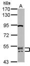 CUGBP Elav-Like Family Member 2 antibody, GTX117035, GeneTex, Western Blot image 