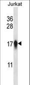 Centromere Protein A antibody, LS-C168663, Lifespan Biosciences, Western Blot image 