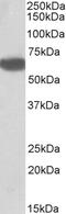 Biotinidase antibody, EB11942, Everest Biotech, Western Blot image 