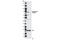 Bruton Tyrosine Kinase antibody, 5082S, Cell Signaling Technology, Western Blot image 