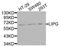 Lipase G, Endothelial Type antibody, A03211, Boster Biological Technology, Western Blot image 