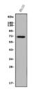 Arylsulfatase E antibody, A10294-3, Boster Biological Technology, Western Blot image 