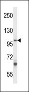Zinc Finger CCCH-Type Containing 12B antibody, LS-C160734, Lifespan Biosciences, Western Blot image 