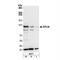 LIM Domain And Actin Binding 1 antibody, NB100-2305, Novus Biologicals, Western Blot image 