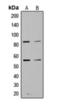 Phosphoinositide-3-Kinase Regulatory Subunit 1 antibody, orb393134, Biorbyt, Western Blot image 