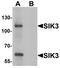 SIK Family Kinase 3 antibody, PA5-72738, Invitrogen Antibodies, Western Blot image 