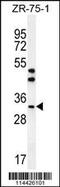 Amphiregulin antibody, 63-196, ProSci, Western Blot image 