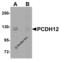 Protocadherin 12 antibody, 5071, ProSci, Western Blot image 