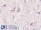 FAP antibody, LS-A8027, Lifespan Biosciences, Immunohistochemistry frozen image 