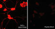 Protein Kinase C Alpha antibody, PP1091, ECM Biosciences, Immunocytochemistry image 