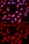 DnaJ Heat Shock Protein Family (Hsp40) Member B1 antibody, GTX54013, GeneTex, Immunofluorescence image 