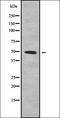 Serpin Family A Member 2 (Gene/Pseudogene) antibody, orb337989, Biorbyt, Western Blot image 