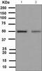 Vitamin D Receptor antibody, ab109234, Abcam, Western Blot image 