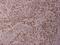 Activating Transcription Factor 2 antibody, PA5-36623, Invitrogen Antibodies, Immunohistochemistry paraffin image 