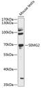 Semenogelin 2 antibody, 14-680, ProSci, Western Blot image 
