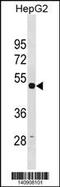 Tubulin Gamma 1 antibody, 60-668, ProSci, Western Blot image 